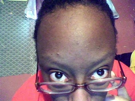 big forehead with glasses.